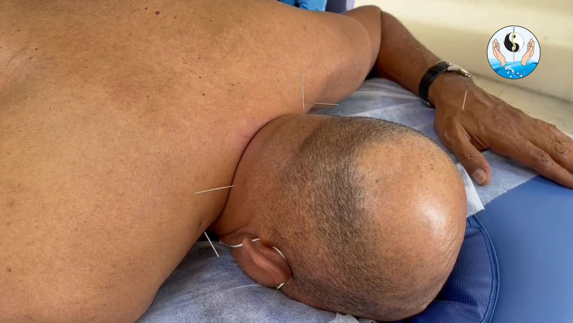 Osteopathic Techniques
